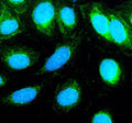 Immunofluorescent staining of TNIP3 using anti-TNIP3 antibody (green). TNIP3 was detected in an immunocytochemical section of human U2OS cells. Enzyme antigen retrieval was performed using IHC enzyme antigen retrieval reagent for 15 mins. The cells were blocked with 10% goat serum. And then incubated with 5 ug/ml rabbit anti-TNIP3 antibody overnight at 4oC. DyLight 488 Conjugated Goat Anti-Rabbit IgG was used as secondary antibody at 1:500 dilution and incubated for 30 min at 37oC.
