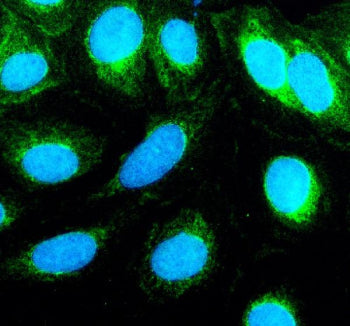 Immunofluorescent staining of TNIP3 using anti-TNIP3 antibody (green). TNIP3 was detected in an immunocytochemical section of human U2OS cells. Enzyme antigen retrieval was performed using IHC enzyme antigen retrieval reagent for 15 mins. The cells were blocked with 10% goat serum. And then incubated with 5 ug/ml rabbit anti-TNIP3 antibody overnight at 4oC. DyLight 488 Conjugated Goat Anti-Rabbit IgG was used as secondary antibody at 1:500 dilution and incubated for 30 min at 37oC.