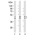 Western blot testing of human 1) HepG2, 2) LNCaP and 3) MDA-MB-453 cell lysate with UGT2B4 antibody. Predicted molecular weight: 43/46/61 kDa (three isoforms).