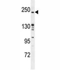 RICTOR antibody western blot analysis in mouse bladder tissue lysate.