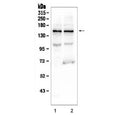 Western blot testing of human 1) K562 and 2) U-2 OS cell lysate with KCNH2 antibody. Expected molecular weight: 127-155 kDa.