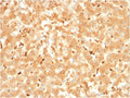 IHC staining of FFPE human liver with Alpha-2-Macroglobulin antibody. HIER: boil tissue sections in pH 9 10mM Tris with 1mM EDTA for 20 min and allow to cool before testing.