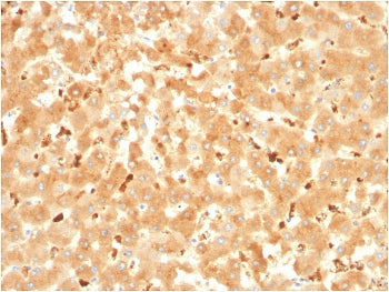 IHC staining of FFPE human liver with Alpha-2-Macroglobulin antibody. HIER: boil tissue sections in pH 9 10mM Tris with 1mM EDTA for 20 min and allow to cool before testing.