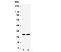 Western blot testing of Surfactant protein A antibody and Lane 1: mouse lung; 2: rat lung tissue lysate. Predicted molecular weight: ~26 kDa but may be observed at higher molecular weights due to glycosylation.