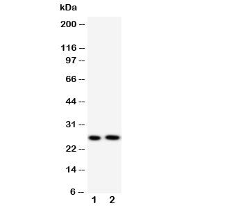 Western blot testing of Surfactant protein A antibody and Lane 1: mouse lung; 2: rat lung tissue lysate. Predicted molecular weight: ~26 kDa but may be observed at higher molecular weights due to glycosylation.