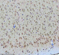 Immunohistochemical staining of Tuberin/TSC2 (Phospho-S939) using anti-Phospho-Tuberin (pSer939) antibody. Tuberin/TSC2 (Phospho-S939) was detected in a paraffin-embedded section of mouse brain tissue. Heat mediated antigen retrieval was performed in EDTA buffer (pH 8.0, epitope retrieval solution). The tissue section was blocked with 10% goat serum. The tissue section was then incubated with a dilution of 1:50 rabbit anti-Phospho-Tuberin (Ser939) antibody overnight at 4oC.
