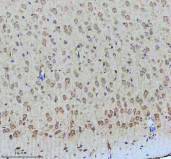 Immunohistochemical staining of Tuberin/TSC2 (Phospho-S939) using anti-Phospho-Tuberin (pSer939) antibody. Tuberin/TSC2 (Phospho-S939) was detected in a paraffin-embedded section of mouse brain tissue. Heat mediated antigen retrieval was performed in EDTA buffer (pH 8.0, epitope retrieval solution). The tissue section was blocked with 10% goat serum. The tissue section was then incubated with a dilution of 1:50 rabbit anti-Phospho-Tuberin (Ser939) antibody overnight at 4oC.