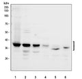Western blot testing of 1) human 293T, 2) human Jurkat, 3) human U-251, 4) human A549, 5) rat spleen and 6) mouse spleen tissue lysate with Aurora B antibody. Predicted molecular weight: 39-45 kDa.