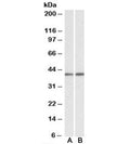 Western blot testing of mouse [A] and rat [B] testis lysates with GNAQ antibody at 0.1ug/ml. Predicted molecular weight ~42kDa.
