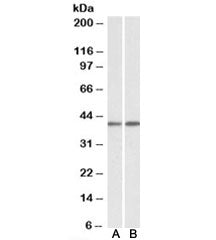 Western blot testing of mouse [A] and rat [B] testis lysates with GNAQ antibody at 0.1ug/ml. Predicted molecular weight ~42kDa.