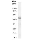 Western blot testing of human brain lysate with Neuroserpin antibody at 1ug/ml. Predicted molecular weight: ~46 kDa.