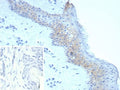 IHC staining of FFPE human skin tissue with Desmoglein 3 antibody (clone DSG3/8251R). Inset: PBS used in place of primary Ab (secondary Ab negative control). HIER: boil tissue sections in pH 9 10mM Tris with 1mM EDTA for 20 min and allow to cool before testing.