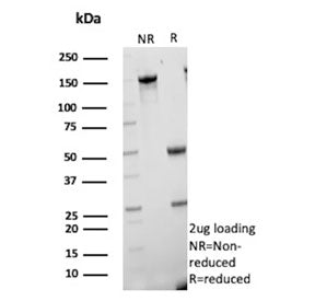 SDS-PAGE analysis of purified, BSA-free CETN1 antibody (clone CETN1/9878) as confirmation of integrity and purity.