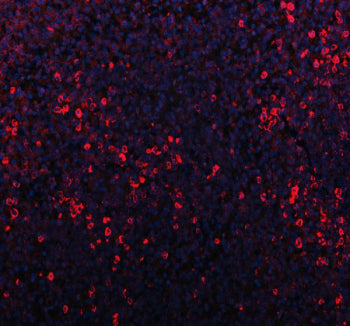 Western blot testing of P2X5 antibody and rat brain lysate. Predicted/observed molecular weight: ~48 kDa.