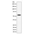 Western blot testing of human Jurkat cell lysate with RNF14 antibody. Predicted molecular weight ~54 kDa.