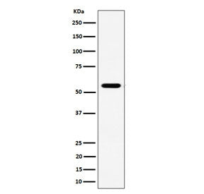Western blot testing of human Jurkat cell lysate with RNF14 antibody. Predicted molecular weight ~54 kDa.