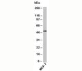 Western blot testing of human samples with RUNX2 antibody at 1ug/ml. Predicted molecular weight: 50-60 kDa.
