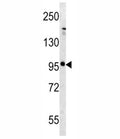Western blot analysis of mGLUR5 antibody and mouse brain tissue lysate