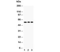 Western blot testing of KLF4 antibody and Lane 1: HeLa; 2: A549; 3: U20S cell lysate. Predicted molecular weight: 50-60 kDa + possible ~75 kDa (phosphorylated form).