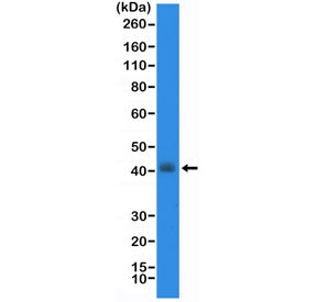 Western blot testing of human TT cell lysate with recombinant Thyroid transcription factor 1 antibody at 1:20,000 dilution. Expected molecular weight: 38-45 kDa.
