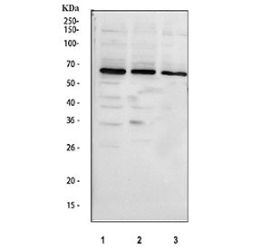 Western blot testing of 1) rat lung, human 2) HeLa, 3) K562 and 4) Jurkat lysate with GRK6 antibody. Expected/observed molecular weight ~66 kDa.