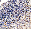 Immunohistochemical staining of SP110 using anti-SP110 antibody. SP110 was detected in a paraffin-embedded section of human tonsil tissue. Heat mediated antigen retrieval was performed in EDTA buffer (pH 8.0, epitope retrieval solution). The tissue section was blocked with 10% goat serum. The tissue section was then incubated with 2 ug/ml rabbit anti-SP110 antibody overnight at 4oC. Peroxidase Conjugated Goat Anti-rabbit IgG was used as secondary antibody and incubated for 30 min at 37oC.