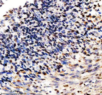 Immunohistochemical staining of SP110 using anti-SP110 antibody. SP110 was detected in a paraffin-embedded section of human tonsil tissue. Heat mediated antigen retrieval was performed in EDTA buffer (pH 8.0, epitope retrieval solution). The tissue section was blocked with 10% goat serum. The tissue section was then incubated with 2 ug/ml rabbit anti-SP110 antibody overnight at 4oC. Peroxidase Conjugated Goat Anti-rabbit IgG was used as secondary antibody and incubated for 30 min at 37oC.