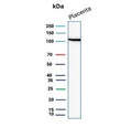 Western blot testing of human placental tissue lysate with recombinant E-Cadherin antibody. Expected molecular weight: 135 kDa (precursor), 80-120 kDa (mature, depending on glycosylation level).