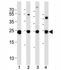PGP 9.5 antibody western blot analysis in (1) U266, (2) NCI-H1299, (3) mouse Neuro-2a cell line and (4) mouse brain tissue lysate. Predicted molecular weight ~25 kDa.