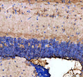 IHC staining of FFPE zebrafish brain tissue with Zebrafish Dnm1 antibody, HRP-labeled secondary and DAB substrate. HIER: boil tissue sections in pH8 EDTA for 20 min and allow to cool before testing.