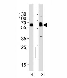 Western blot analysis of lysate from (1) SW480 and (2) U-87 MG cell line using TH antibody at 1:1000. Predicted molecular weight 55~60 kDa.