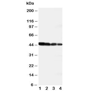 Western blot testing of DLL3 antibody and recombinant human protein; Lane 1: 10ng; 2: 5ng; 3: 2.5ng; 4: 1.25ng
