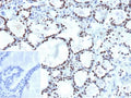 IHC staining of FFPE human thyroid tissue with NKX2.1 antibody (clone NX2.1/9033). Inset: PBS used in place of primary Ab (secondary Ab negative control). HIER: boil tissue sections in pH 9 10mM Tris with 1mM EDTA for 20 min and allow to cool before testing.