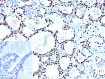 IHC staining of FFPE human thyroid tissue with NKX2.1 antibody (clone NX2.1/9033). Inset: PBS used in place of primary Ab (secondary Ab negative control). HIER: boil tissue sections in pH 9 10mM Tris with 1mM EDTA for 20 min and allow to cool before testing.