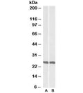 Western blot testing of mouse [A] and rat [B] brain lysate with UCHL1 antibody at 0.01ug/ml. Predicted molecular weight ~25kDa.