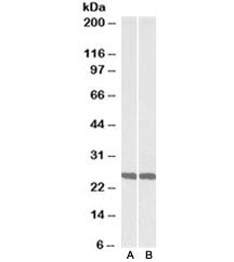 Western blot testing of mouse [A] and rat [B] brain lysate with UCHL1 antibody at 0.01ug/ml. Predicted molecular weight ~25kDa.