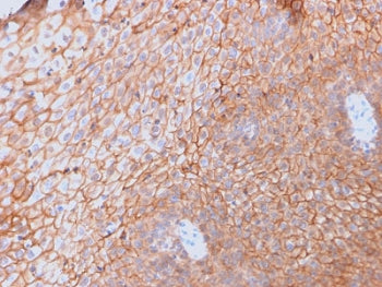 IHC testing of FFPE human spleen with CD40 Ligand antibody (clone CD40LG/2761). HIER: boil tissue sections in pH6, 10mM citrate buffer, for 10-20 min followed by cooling at RT for 20 min.