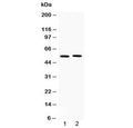 Western blot testing of 1) rat spleen and 2) human MM231 lysate with MMP11 antibody at 0.5ug/ml. Predicted molecular weight ~55 kDa.