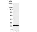 Western blot testing of TNF beta antibody and Lane 1: recombinant human protein 10ng; 2: 5ng; 3: 2.5ng