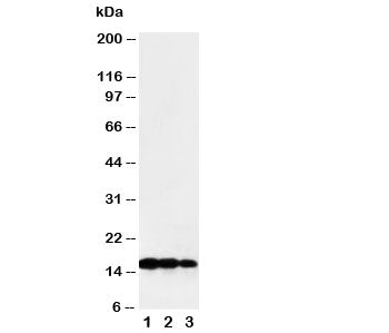 Western blot testing of TNF beta antibody and Lane 1: recombinant human protein 10ng; 2: 5ng; 3: 2.5ng