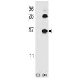 Western blot analysis of FABP4 antibody and 293 cell lysate (2 ug/lane) either nontransfected (Lane 1) or transiently transfected (2) with the FABP4 gene. Predicted molecular weight ~15 kDa.