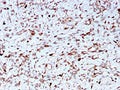 IHC staining of FFPE human liver with C1QA antibody. HIER: boil tissue sections in pH 9 10mM Tris with 1mM EDTA for 10-20 min and allow to cool before testing.