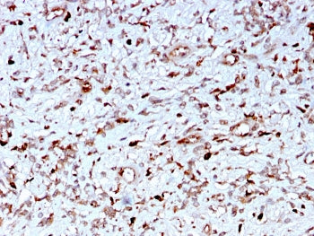 IHC staining of FFPE human liver with C1QA antibody. HIER: boil tissue sections in pH 9 10mM Tris with 1mM EDTA for 10-20 min and allow to cool before testing.