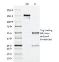 SDS-PAGE Analysis of Purified, BSA-Free MRP1 Antibody (clone MRP1/1344). Confirmation of Integrity and Purity of the Antibody.
