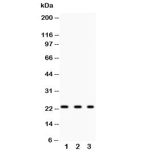 Western blot testing of GST pi antibody and lysate from: 1) rat kidney; 2) human HeLa; 3) human COLO320; Predicted molecular weight ~23 kDa.