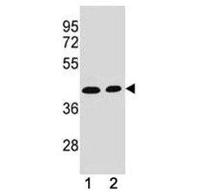 ADA antibody western blot analysis in (1) CEM and (2) Jurkat lysate. Expected/observed molecular weight ~41 kDa.