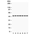Western blot testing of 1) rat lung, 2) rat kidney, 3) rat brain, 4) human HeLa, 5) SMMC, 6) A549 and 7) mouse NIH3T3 lysate with IDH1 antibody. Predicted/observed molecular weight ~47 kDa.