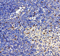IHC staining of FFPE human spleen tissue with Interleukin-2 antibody, HRP-labeled secondary and DAB substrate. HIER: boil tissue sections in pH8 EDTA for 20 min and allow to cool before testing.