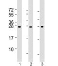 Western blot testing of human 1) human liver, 2) RPMI-8226 and 3) SH-SY5Y lysate with NT5M antibody at 1:2000. Predicted molecular weight:26 kDa.