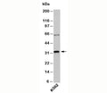 Western blot testing of human samples with RAX antibody at 1ug/ml.